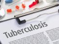 4 Pilar Upaya Percepatan Penanganan Tuberkulosis di Indonesia