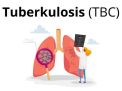 Kepedulian & Edukasi Tentang Tuberkulosis Perlu Lebih Ditingkatkan