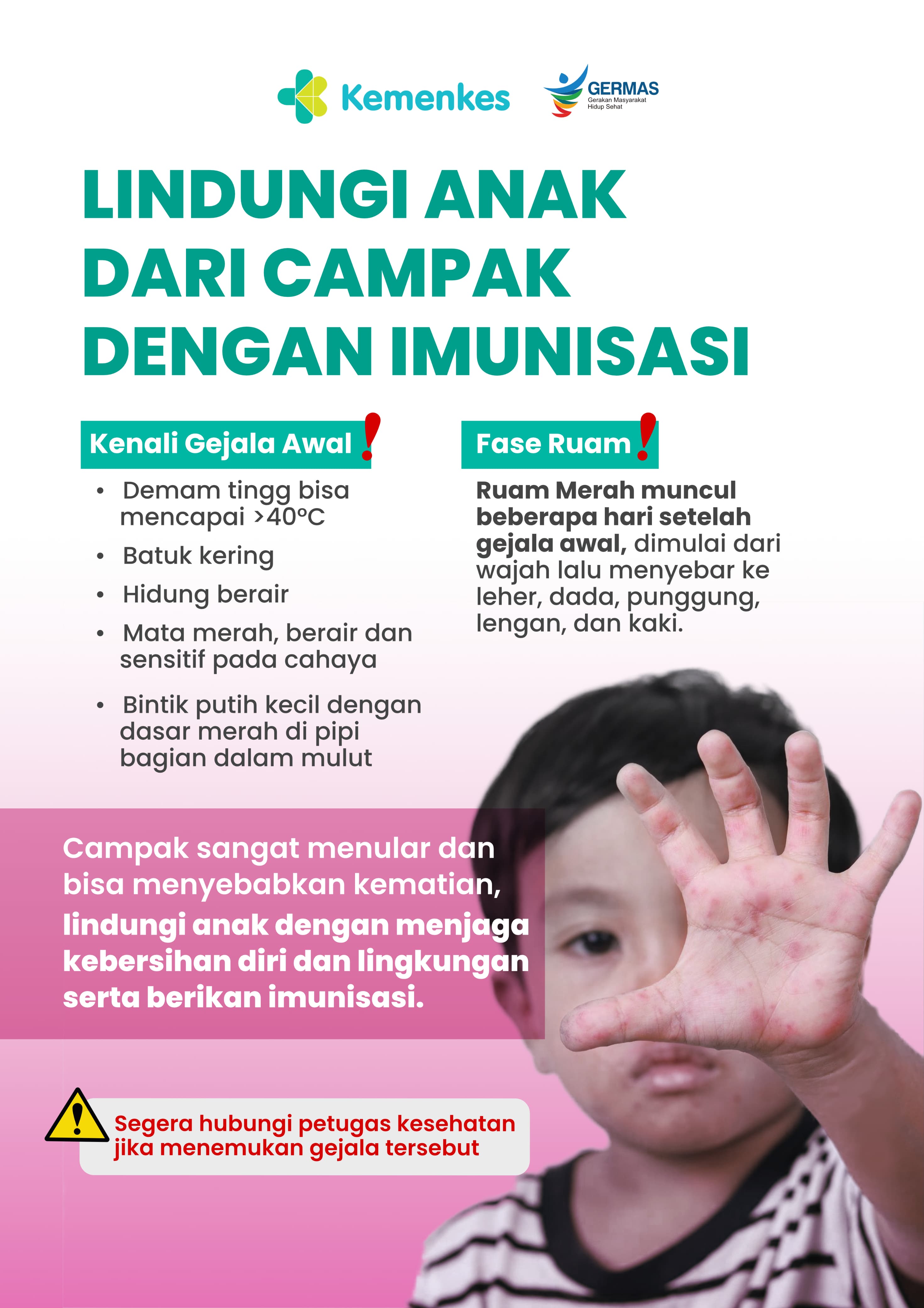 Lindungi Anak Dari Campak 03