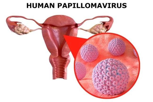 Skrining Kanker Serviks Masuk Program Cek Kesehatan Gratis Mulai 2026