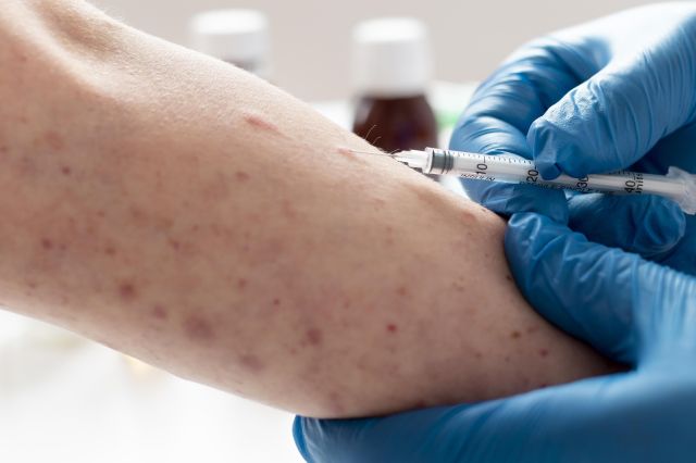 Kemenkes Minta Warga Waspadai Penularan Campak Jelang Mudik dan Lebaran, Percepat Imunisasi di Daerah Berisiko