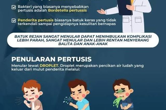 26 Anak Aceh Terkonfirmasi Batuk 100 Hari, Ini Kiat Mencegahnya